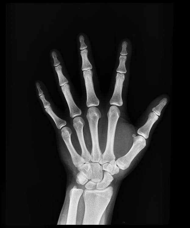 If you look closely...you can clearly see that the thumb is shorter...