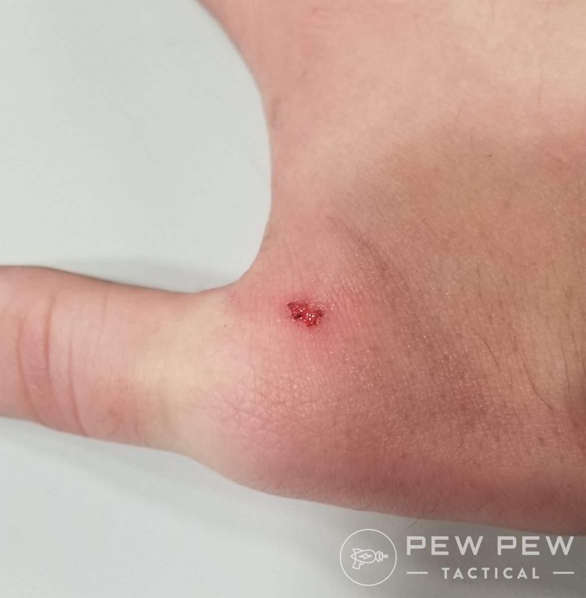 Springfield SA-35 hammer bite